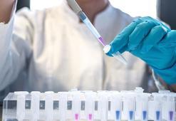 Evde temizlik yaparken gerçeği öğrendi! HIV pozitif olduğunu eşinden saklamıştı, cezası belli oldu