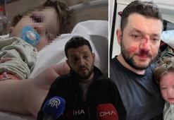 Türkiye’yi ayağa kaldıran olayda yeni gelişme! 14 aylık bebeği hastanelik ettiler: İddiaların odağındaki komşu konuştu