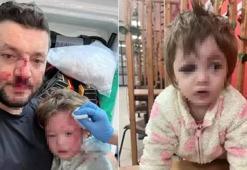 Yalova'da İkra bebek ve babasına saldıran komşunun ifadesi kan dondurdu