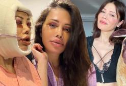 Yüz nakli yaptıran Didem Ceran ağlayarak açıkladı! 'Kanser sürecindeyim'