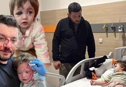 Yalova'daki komşu kavgasında karar: Çocuk skuter'ı 'silah' sayıldı!