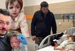 Yalova’daki komşu kavgasında dikkat çeken karar: Skuter 'silah' sayıldı