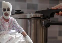 İftar vakti acele etti, feci sonla bitti! ‘Yüzüme elimi sürdüm, et parçası geliyordu'