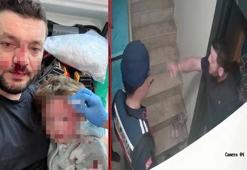 Türkiye'nin konuştuğu olay! Baba ile 14 aylık bebeği darbedilmişti: Yeni görüntüler ortaya çıktı
