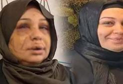 Jiletli saldırıya ağır ceza yolu