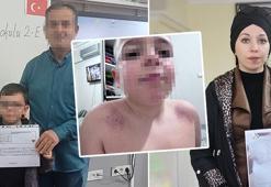 İlkokulda ‘karanlık oda’ dehşeti iddiası! Öğretmen hakkında darp şikayeti
