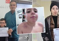 İlkokulda velileri ayağa kaldıran iddia! Öğretmen hakkında darp şikayeti