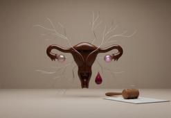 Her ay kabusa dönüyorsa dikkat! Şiddetli adet ağrısının altından o sinsi kist çıkabilir