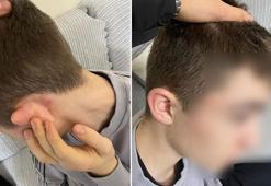 Ekmek almaya giden 14 yaşındaki çocuğu 'hırsız' diye öldüresiye dövdüler