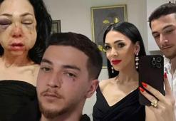 Bayram kabusunda son perde! Darbedilen annenin feryadı: Saçlarım kazındı, mama ile besleniyorum