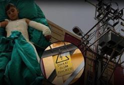 Trafoya takılan uçurtmasını almak isteyen çocuk elektrik akımına kapıldı