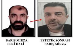 Cinayete azmettirmekten aranan şüpheli, estetikle yüzünü değiştirmiş