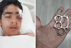 Akran zorbalığına bir yenisi eklendi! 15 yaşındaki çocuk muştayla öldüresiye dövüldü