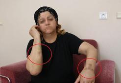 16 yıldır dini nikahla yaşadığı kişi dehşeti yaşattı! 30 yerinden bıçakladı