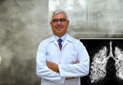 Sigaraya başlama yaşı 12'ye düştü! Prof. Dr. Kılınç: Türkiye'de her 4.5 dakikada bir kişi akciğer kanserinden yaşamını yitiriyor