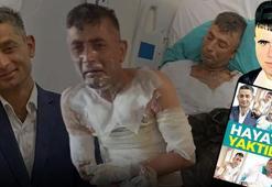 Vahşet cezasız kalmadı! POSTA manşet yapmıştı: Engelli Ahmet'i yakan cani için indirim bile yok
