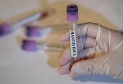 Kovid-19 benzeri pandemi beklenmiyor! Küresel salgın riski düşük