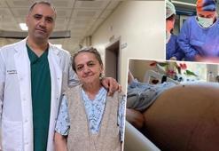 Aylarca kabızlık sandı! Karnındaki dev kitle doktorları şaşkına çevirdi