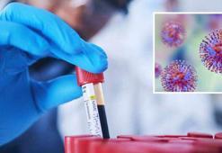 Laboratuvardan kaçırdılar! 113 adet tüpte virüs ve insan DNA'sı: 'Kendilerini kanundan üstün gördüler'