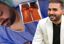 Kadir Ezildi ameliyat oldu! Vücudundan çıkanlar şoke etti