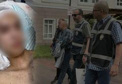 İntihar denildi, cinsel istismar çıktı: Komadan uyanan çocuk gerçeği anlattı! 'Direndiğim için ateş açtı'