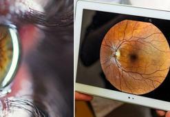 Tıp dünyasını ayağa kaldıracak keşif! Vitamin eksikliği taşıyan kişiler artık böyle tespit edilecek