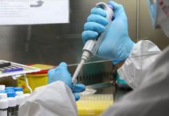 Ünlülere uyuşturucu soruşturmasında 7 şüphelinin test sonucu belli oldu
