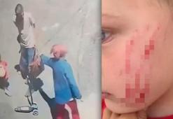 Van’da akılalmaz olay! Sokakta oynayan 4 yaşındaki çocuğa saldırdı