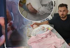 Hastanede korkunç olay! 5 aylık bebeğin parmağı sargı kesilirken koptu