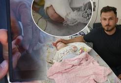 Hastanede korkunç hata! Sargı açılırken 5 aylık bebeğin parmağı koptu