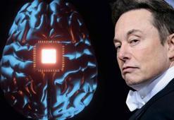 Elon Musk'ın beyin çipine Türk doktorlardan yanıt!​ Madalyonun iki yüzü: Mucize mi, tehdit mi?