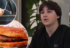 Hamburgerinden aldığı bir ısırık hayatını altüst etti! Bağırsağı delindi, acil ameliyata alındı