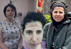 Baş ağrısıyla gitti, alnı çöktü! 'Eski fotoğraflarıma bakarak karar verdim'