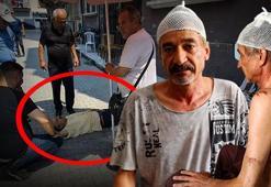 Sokakta çay içerken dehşeti yaşadı! Kafasına 11 dikiş atıldı