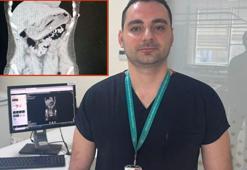 Zayıflamak uğruna kendine yaptığına doktorlar bile inanamadı!