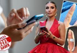 İrem Derici'nin parmağı yamuldu, sebebi ortaya çıktı! Uzman isim uyardı: Vücudunuz size 'Lütfen biraz dur' diyordur