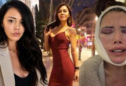 Yüz nakli sonrası yine ameliyat olan Didem Ceran ağlayarak isyan etti! 'Hakkım helal değil'