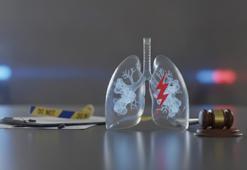 Akciğer sönmesi ve pulmoner emboli habercisi olabilir!