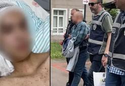 Tacize direnince başından vuruldu! 14 yaşındaki çocuk felç kaldı