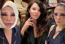 İki kez yüzünü gerdiren Didem Ceran'dan estetik açıklaması! 'Kim Kardashian yöntemleri uygulanacak'