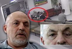 Gözlükten kurtulmak istedi, sol gözünden oldu! Hastaneden ‘mendil’ açıklaması
