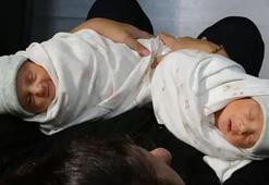 Tıp dünyasını şaşırtan olay! İki ayrı rahminde aynı anda hamile kaldı, ikizlerini kucağına aldı