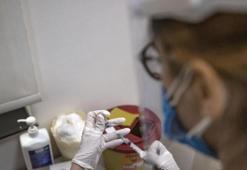 Cilt kanserine karşı mRNA hamlesi! Onaylanırsa tedavide çığır açabilir
