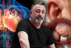 Kulak memesindeki o çizgi ne anlama geliyor? Cem Yılmaz'ın rahatsızlığı sonrası uzmanlardan kritik uyarı!
