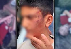İstanbul'da epilepsi hastası çocuğa akran dehşeti! 'Hastalığım var' diye yalvardı: 'Anne beni öldürecekler'
