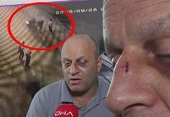 Kızıyla fırına giden babaya motosiklet çarptı! Sürücü arkasına bile bakmadan kaçtı