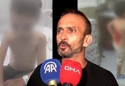 12 yaşındaki Batuhan’ı arkadaşları kolonya ile yaktı! 'Biri çocuğu tutarken diğeri döküyor'