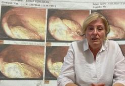Safra kesesi ameliyatı oldu, gerçeği 4 yıl sonra öğrendi! Hayatının şokunu yaşadı