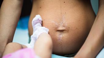 Hamilelikte koku hassasiyeti neyin belirtisidir, ne zaman geçer? Koku tiksintisi ne zaman başlar?