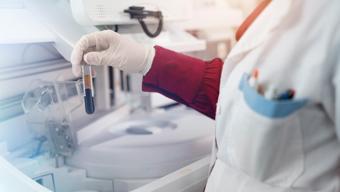 Kan uyuşmazlığı nedir, nasıl olur? Kan uyuşmazlığı olursa ne olur?